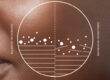 Close-up of skin with a circular graphic overlay divided in two. The left side, labeled "Balanced Microbiome," shows fewer white particles and smoother lines. The right side, labeled "Unbalanced Microbiome," shows more white particles and irregular lines.